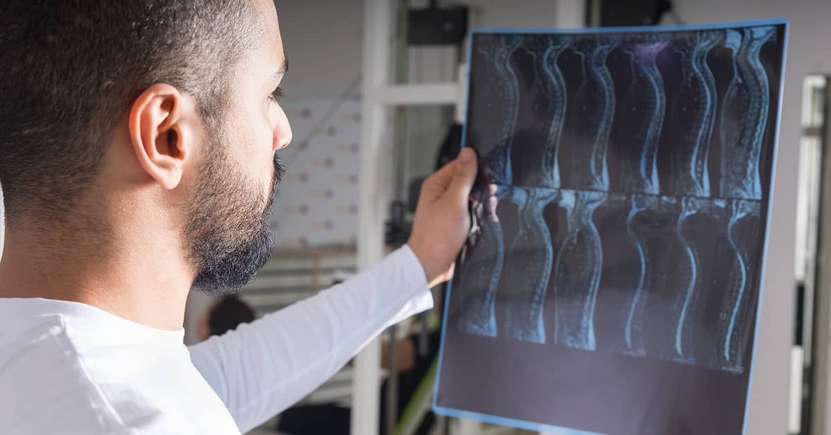Damages in a Spinal Cord Injury Claim