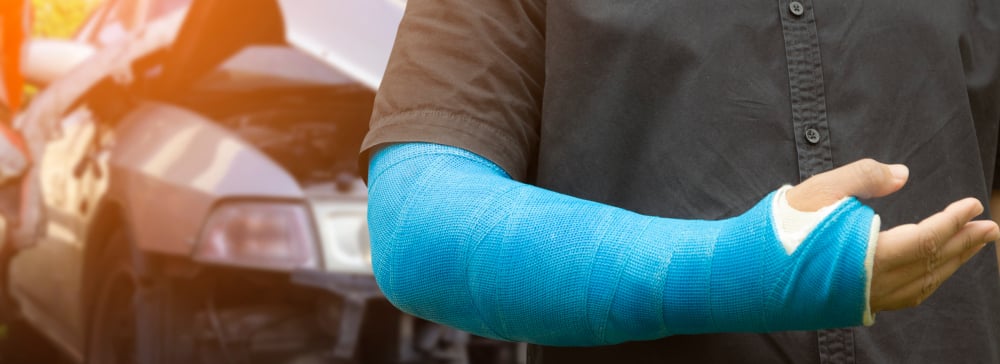 Man with broken arm in cast standing in front of a wrecked car