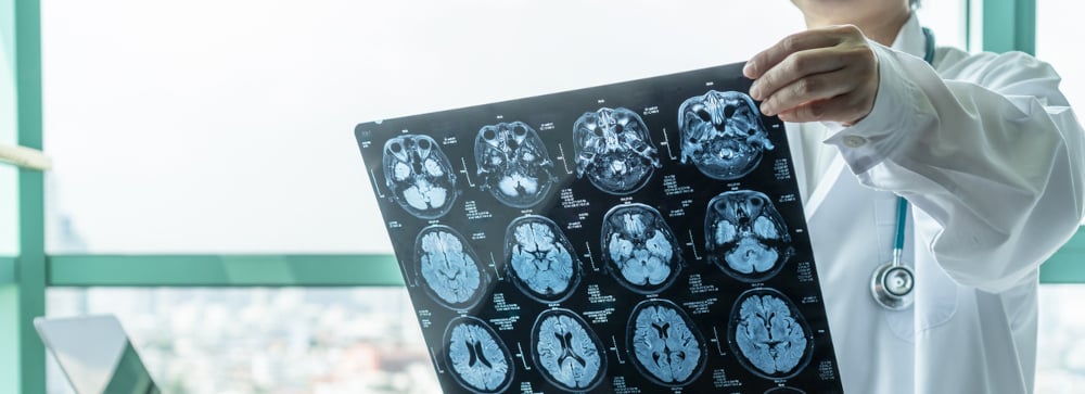 Doctor reviewing brain scan MRI images in a hospital