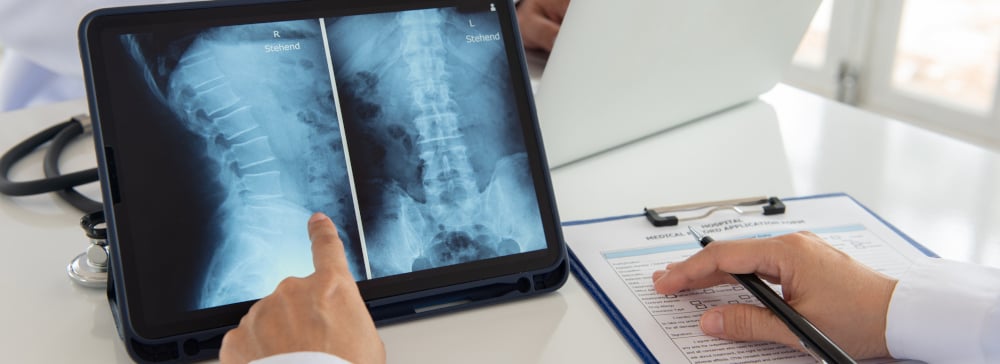 A doctor looking at an X-ray of a spinal cord injury on a tablet computer