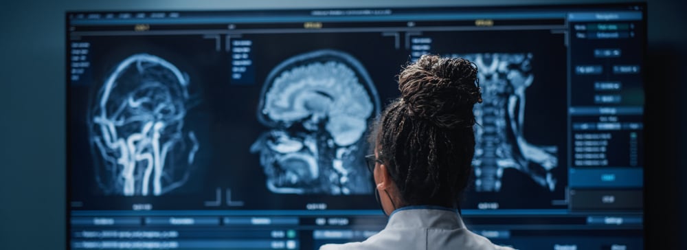 Doctor in a hospital reviewing screens showing a brain injury