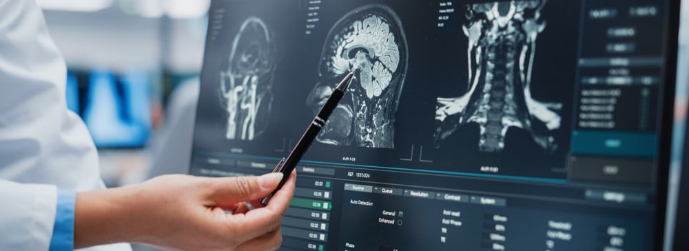 Neurologist using a pen to point to a brain scan on a computer screen