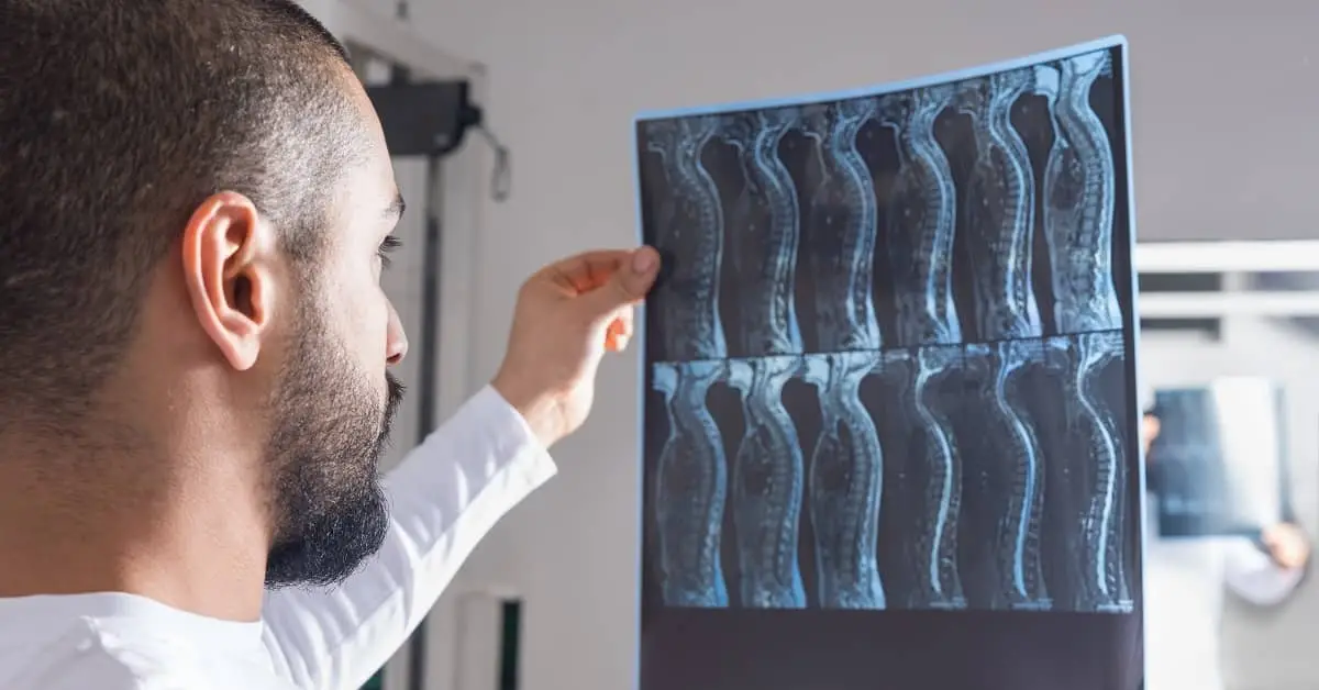 Compensation in a Spinal Cord Injury Claim